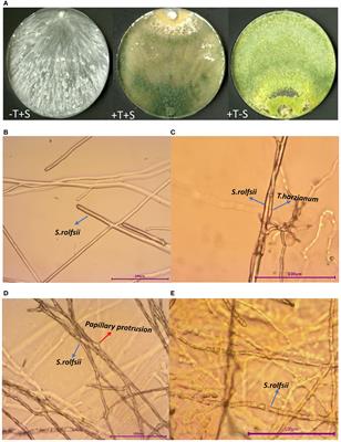 The growth-promoting and disease-suppressing mechanisms of Trichoderma inoculation on peanut seedlings